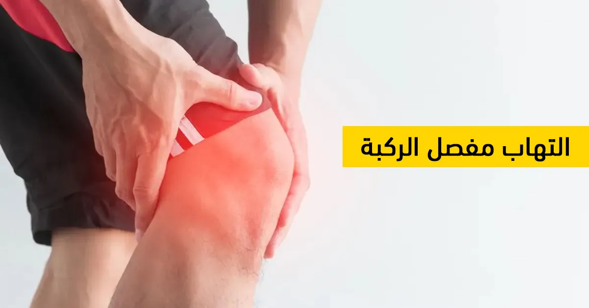 التهاب مفصل الركبة